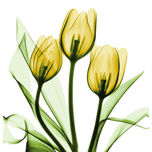 Golden X-Ray Tulips Shower Curtain